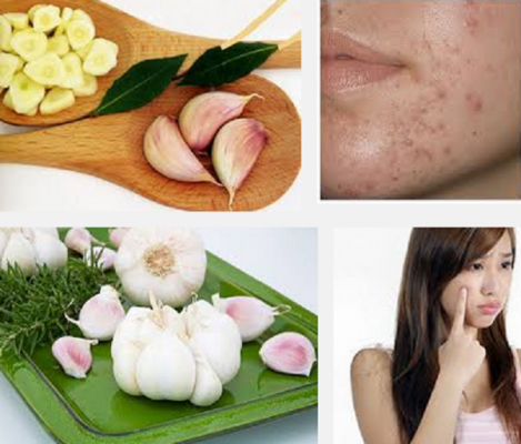 tri-mun-lam-trang-da-trong-5-ngay-nho-toi-cuc-ki-hieu-qua-phunubeo-1